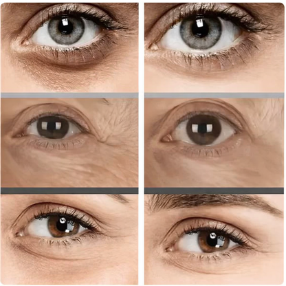 Instant Eyelift in Under 10 Minutes — Lasts All Day