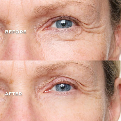 Instant Eyelift in Under 2 Minutes — Lasts All Day